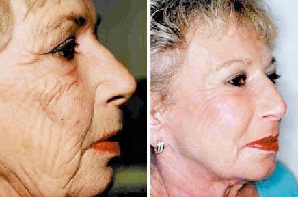 by Dr. Harold Bafitis